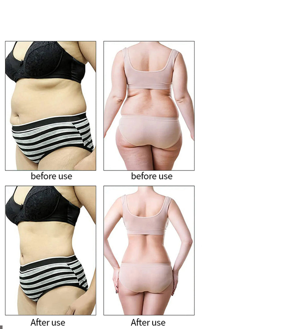 Dispositivo Estético 3 en 1 RF & EMS con Ultrasonido de Cavitación para Adelgazamiento Corporal, Lifting Facial y Reafirmante de Piel – Máquina Profesional de Cuidado Facial y Corporal