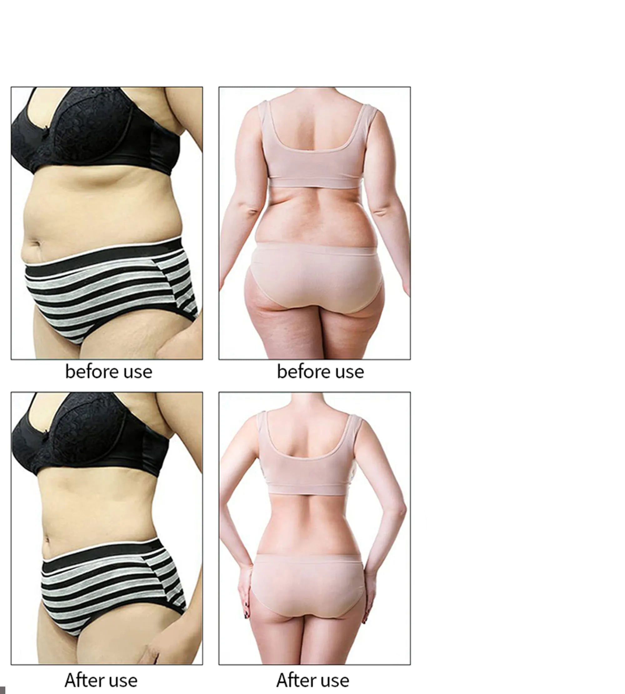 Dispositivo Estético 3 en 1 RF & EMS con Ultrasonido de Cavitación para Adelgazamiento Corporal, Lifting Facial y Reafirmante de Piel – Máquina Profesional de Cuidado Facial y Corporal